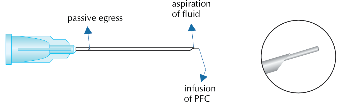 (Perflurocarbon Co-Axial I/A Cannula)